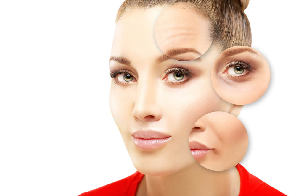Areas of the face that benefit from Botox