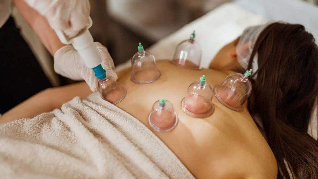 is cupping better than a massage