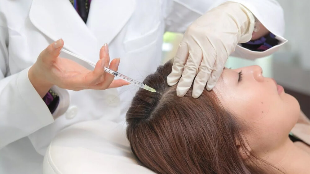 mesotherapy for hair loss