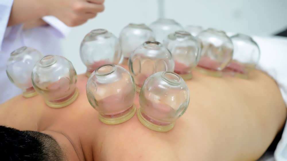 midsection of woman is cupping therapy in spa