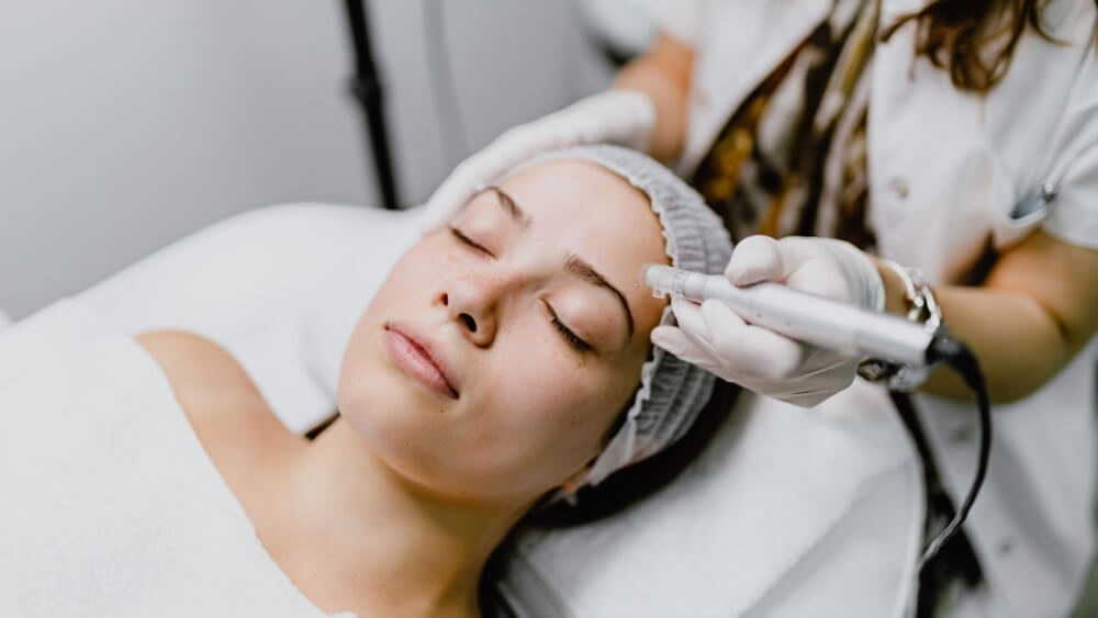 young woman having a microneedling