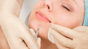 Venus-Clinic-Skin-Deep-Cleansing-Facial