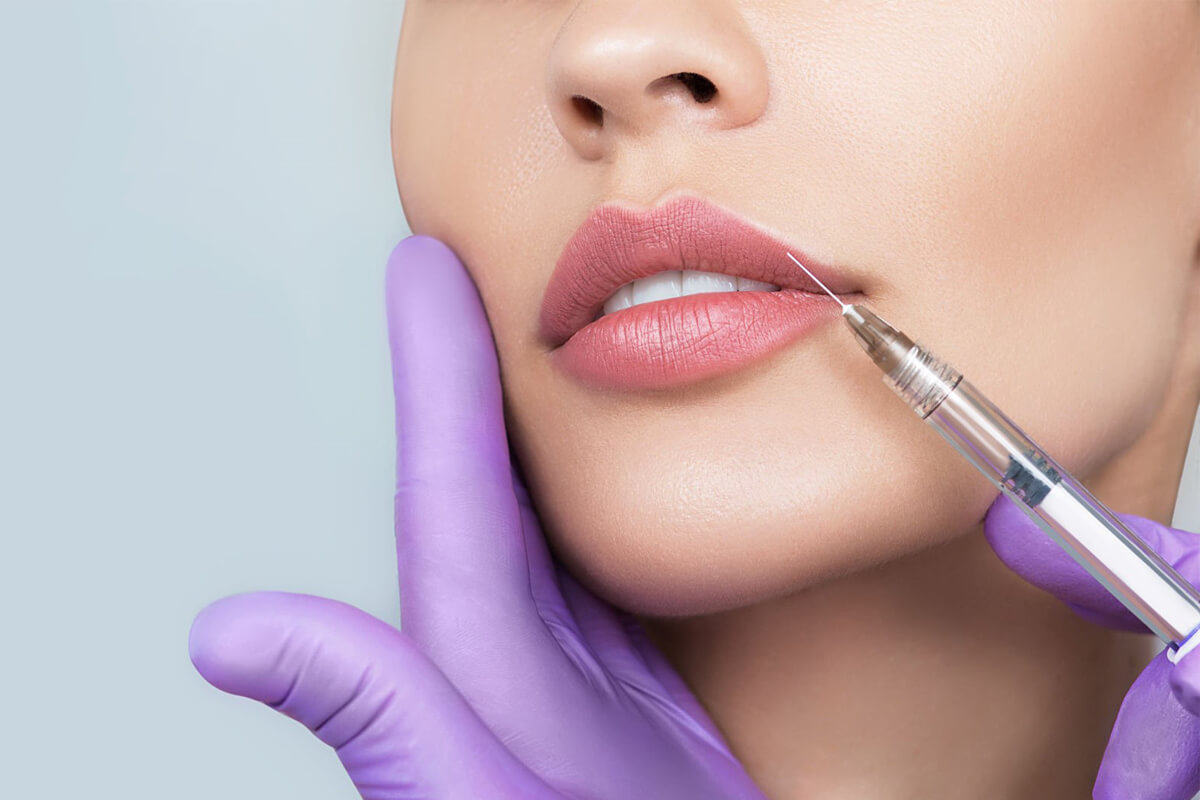 Lips-Filler-Injection-ٰVenus-Skin-Clinic