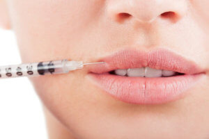 The benefits of lips filler injection